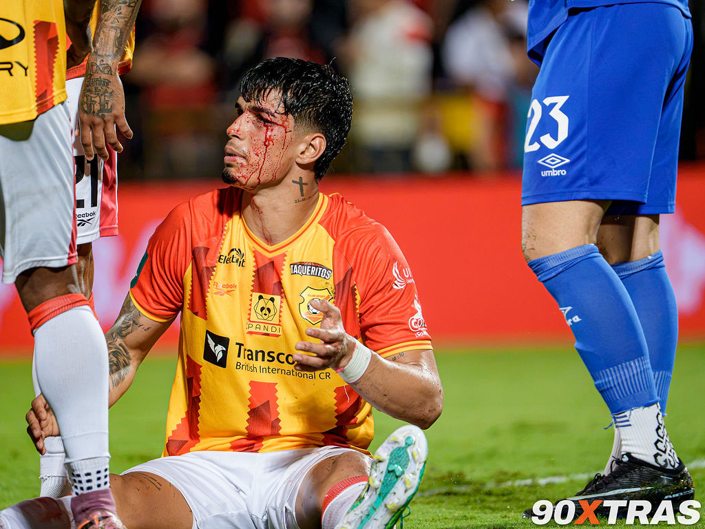 Alajuelense vs Herediano, foto 10 de 36