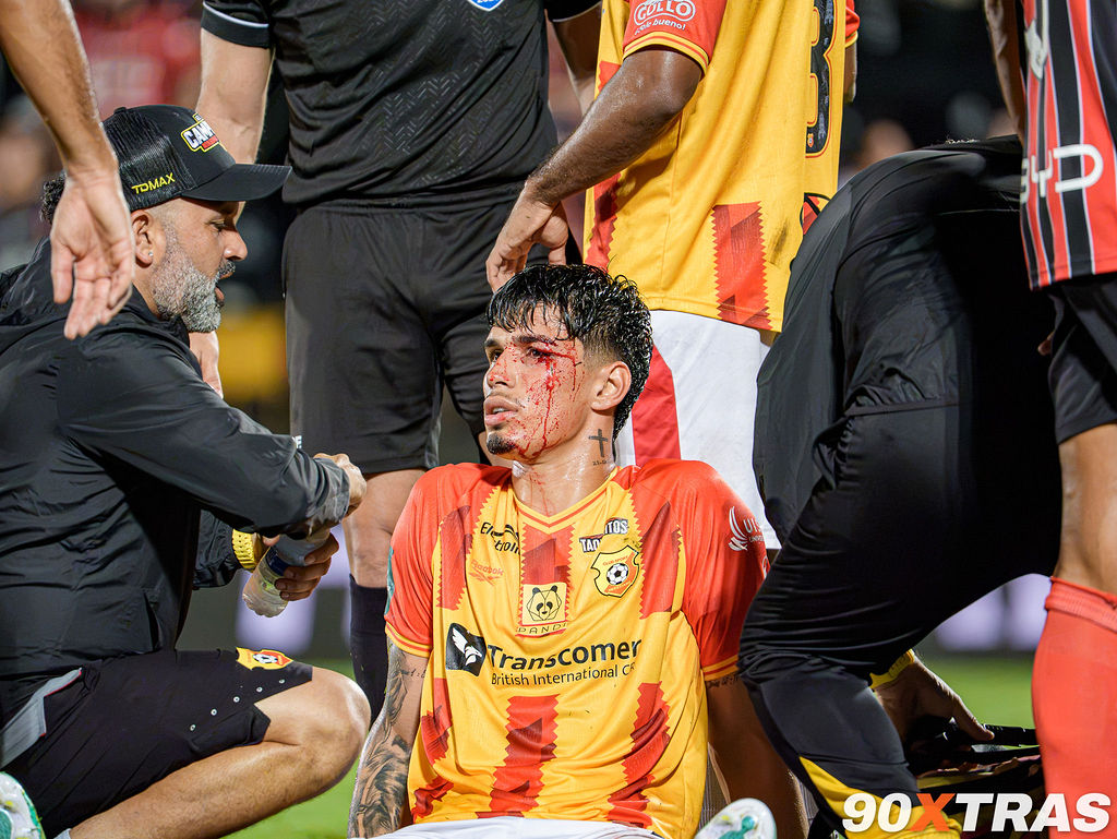 Alajuelense vs Herediano, foto 11 de 36